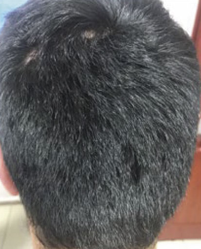 Registro posterior do caso PRP 2