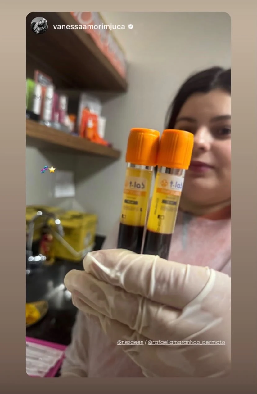 Profissional apresenta dois tubos PRP T-LAB em ambiente clínico
