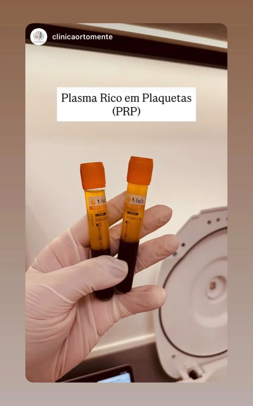 Tubos PRP T-LAB apresentados por profissional