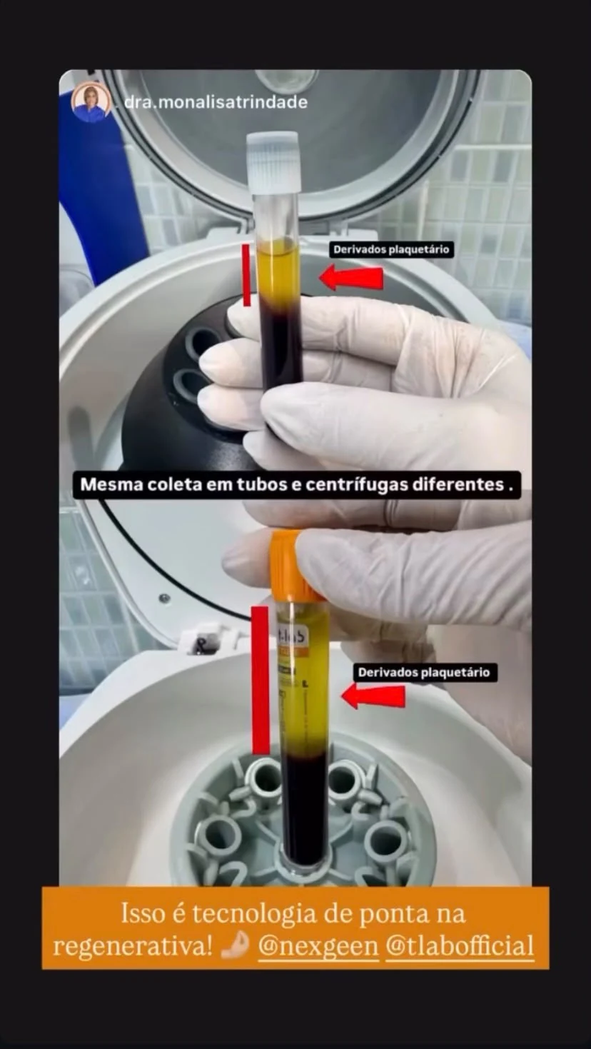 Registro profissional de derivados plaquetários após processamento