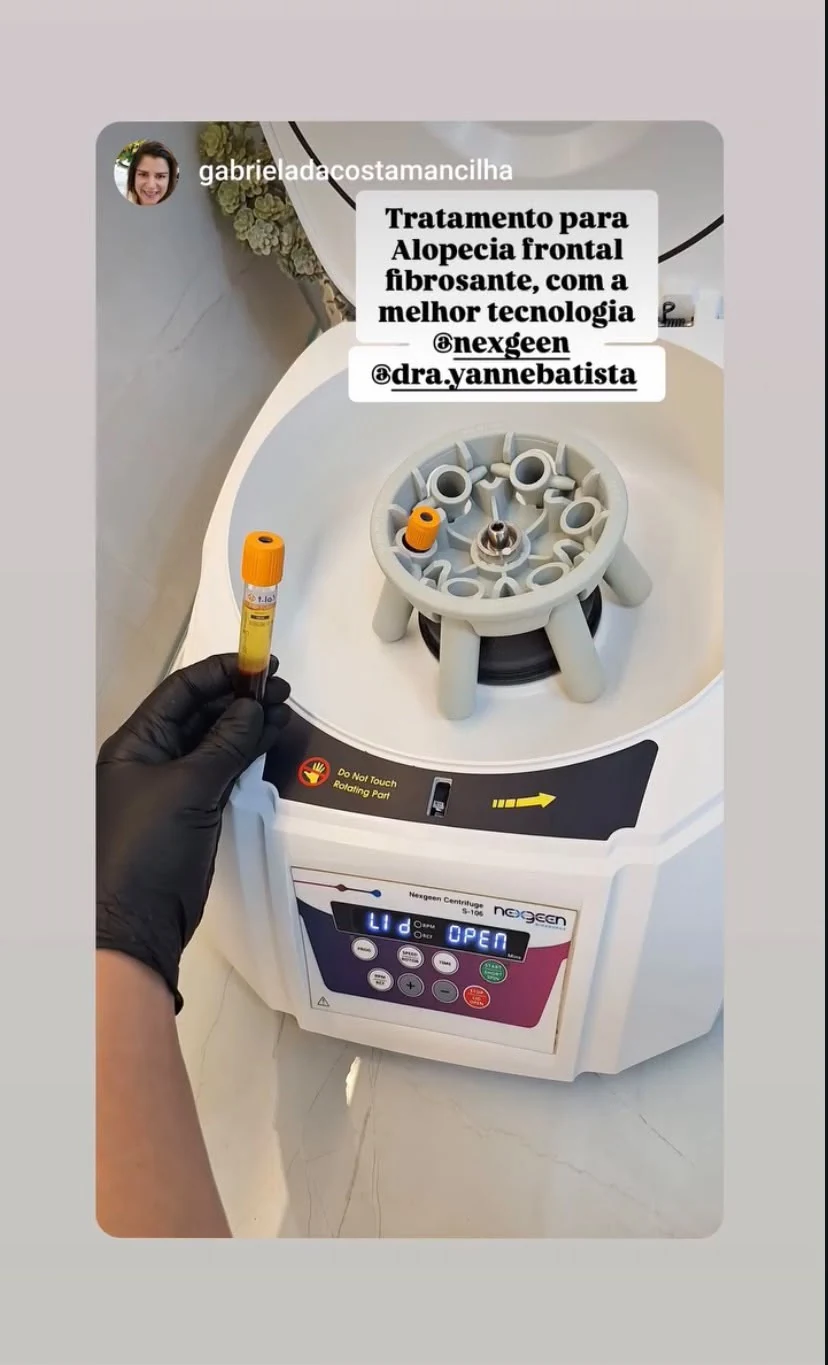 Tubos PRP T-LAB e centrífuga em ambiente clínico