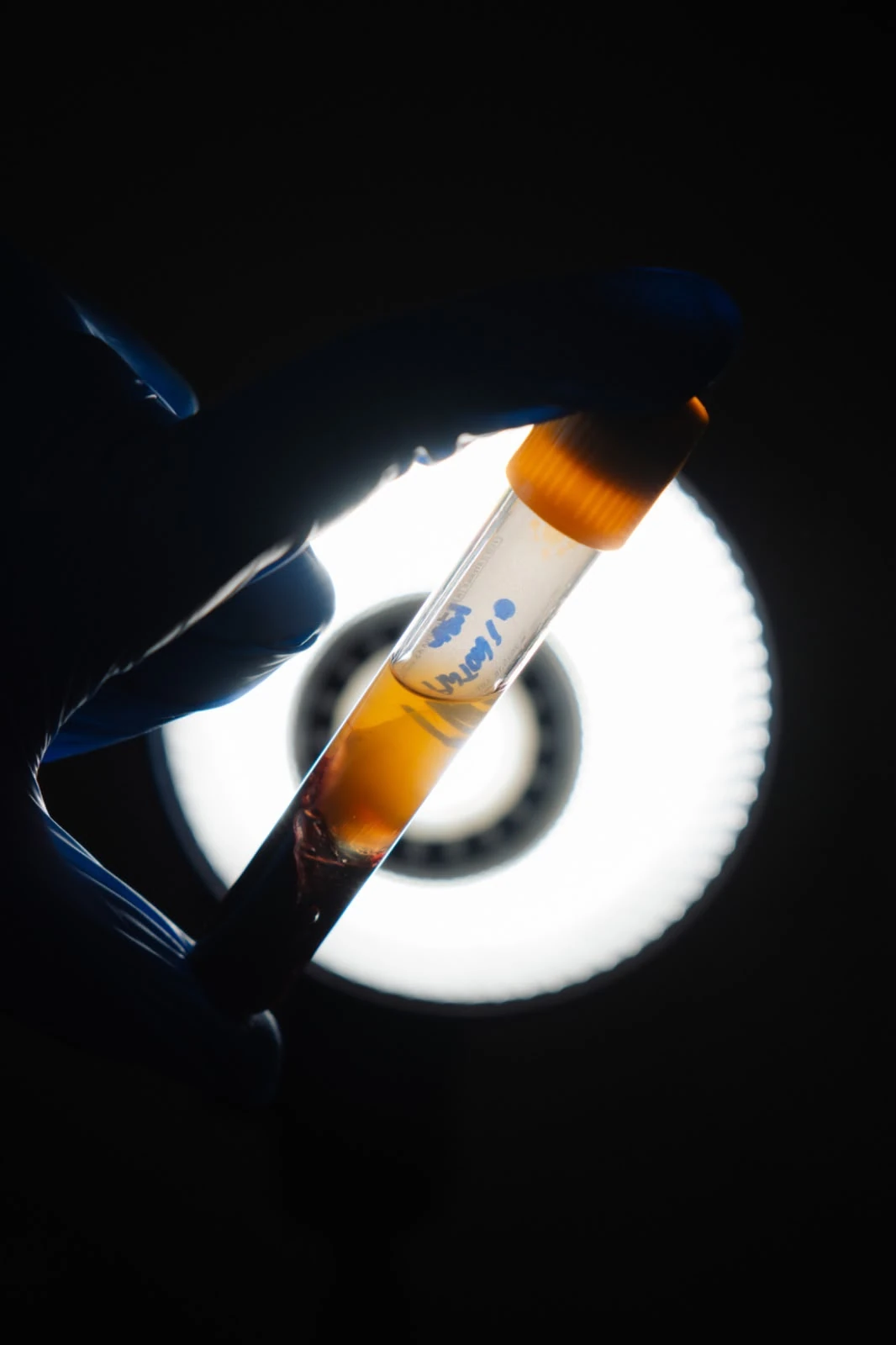 Tubo PRP com tampa laranja, segurado por profissional com luva azul
